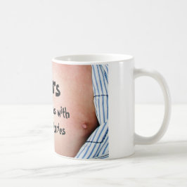 Narben sind Tätowierungen mit besseren Geschichten Kaffeetasse