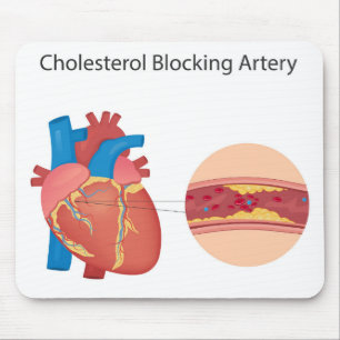 Narkose Blutgefäße Mousepad