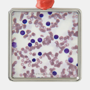 Neoplastische Lymphozyte-Zellen Silbernes Ornament