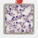 Neoplastische Lymphozyte-Zellen Silbernes Ornament (Vorne)