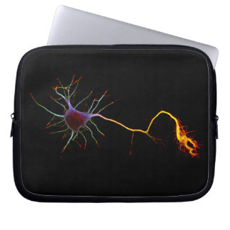 NeuroFlame Laptop Sleeve ,(Plastic Version),