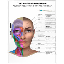 Neurotoxin Injektionsnadeln Trockene Erase-Karte