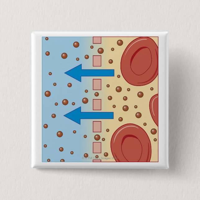 Nierendialyse Button (Vorderseite)