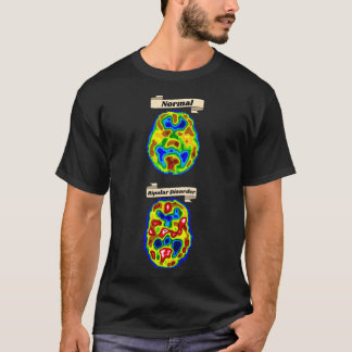 Normal vs Bipolar Gehirnscan T-Shirt