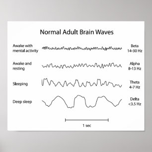 Normale erwachsene Hirnwellen Eeg Poster