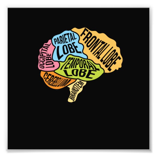 Operation der Hirnteile Doktor Neurologie Fotodruck (Vorne)