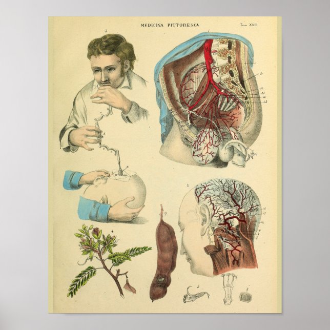 Operation Kopf Anatomie Art Doktor Print Poster (Vorne)