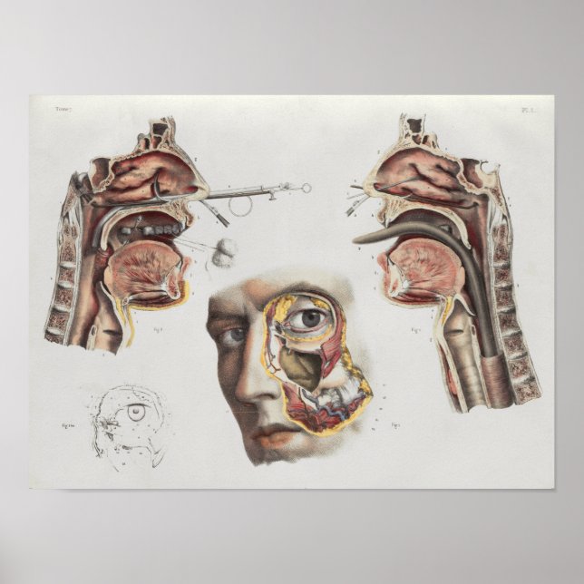Operation Medizinische Technik Vintage Anatomie Dr Poster (Vorne)
