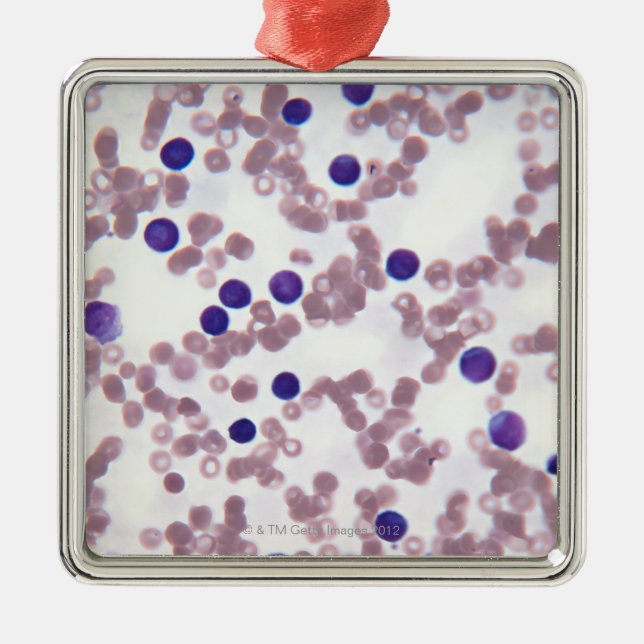 Ornement En Métal Cellules néo-plastiques de lymphocyte (Devant)