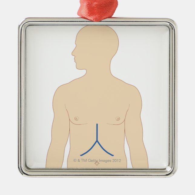 Ornement En Métal Greffe de foie (Devant)