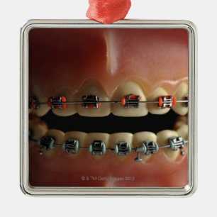Ornement En Métal Un modèle dentaire et croisillons de dents
