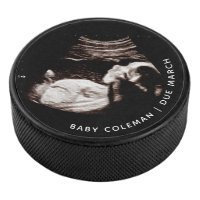 Grossesse Bébé Sonogramme Ultrasons Photo