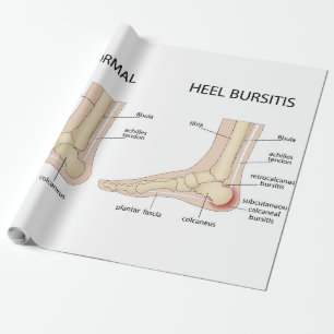 Papier Cadeau La difformité de Haglund