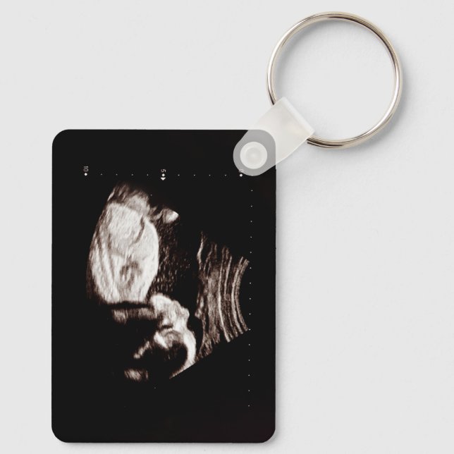 Personalisiert Baby Ultrasound Schlüsselanhänger (Rückseite)