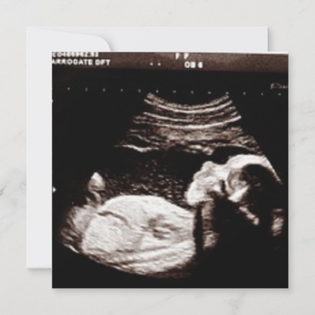Personalisierte Ultraschallbild Babydusche Einladung (Vorderseite)