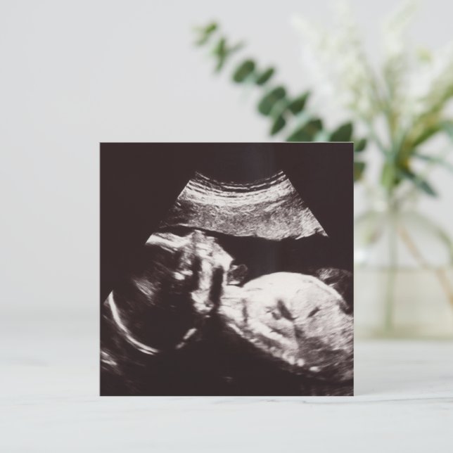 Personalisierte Ultraschallbild Babydusche Einladung (Stehend Vorderseite)