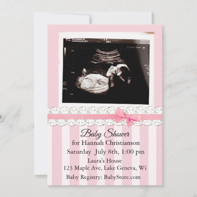 Personalisierte Ultrasound Baby Dusche Einladungen (Vorderseite)