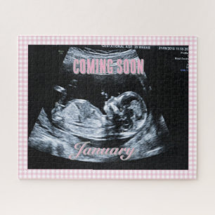 Personalisiertes Geschlecht- Enthüllungs- Sonogram