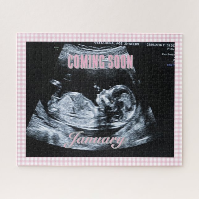 Personalisiertes Geschlecht- Enthüllungs- Sonogram (Horizontal)