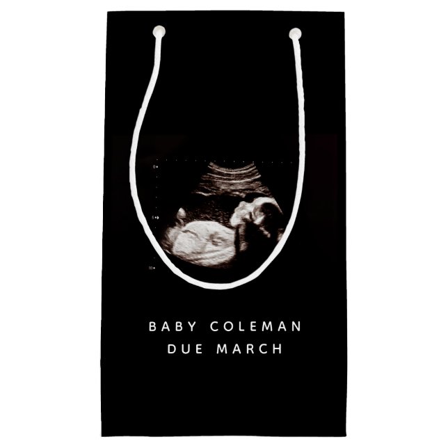 Petit Sac Cadeau Pregnancy Baby Sonogramme Ultrasound Photo (Devant)