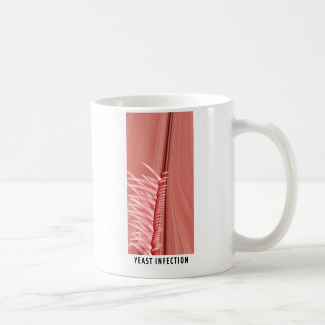 Pilzinfektion Kaffeetasse (Rechts)