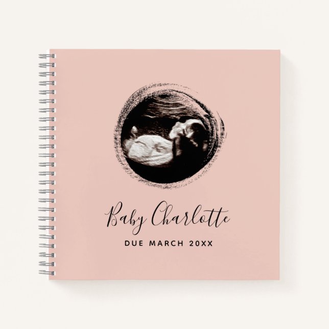Pink Baby Girl Sonogram Ultrasound Schwangerschaft Notizbuch (Vorderseite)