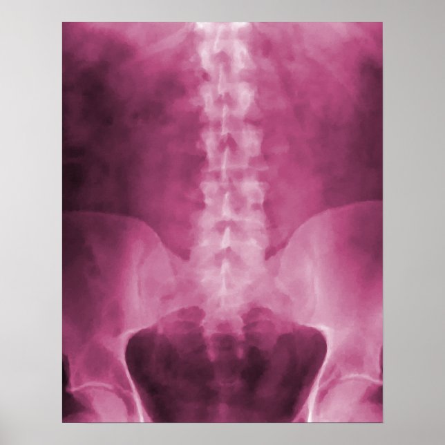 Pink Digital X-Ray Art Print Poster (Vorne)