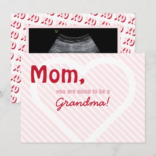 Pink Oma Valentine Ultrasound Schwangerschaft Ankündigung (Vorne/Hinten)
