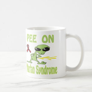 Pipi sur la tasse de syndrome de Marfan
