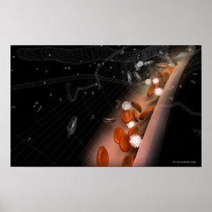 Plakette in den Arterien Poster