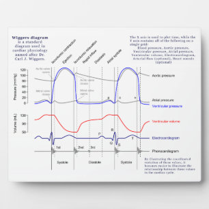 Plaque Photo Diagramme de Wiggers