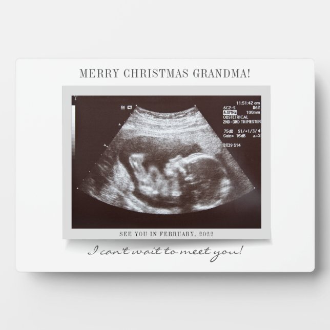 Plaque Photo Joyeux Noël Grand-mère Baby Revey Scan (Devant)