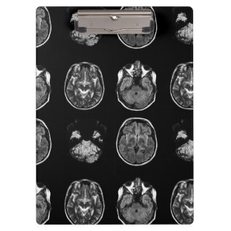Porte-bloc Analyse IRM du cerveau