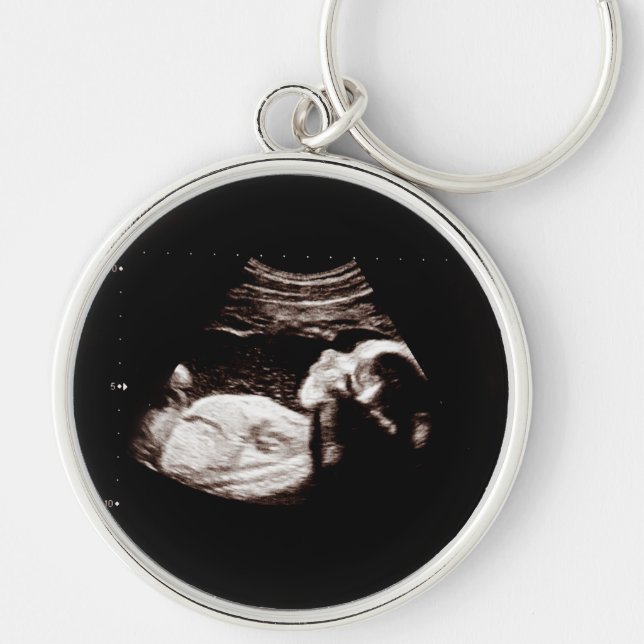 Porte-clés Grossesse Bébé Sonogramme Ultrasons Photo Nouvelle (Devant)