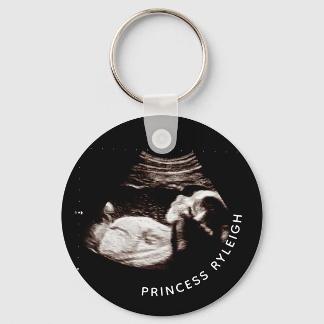 Porte-clés KG_Grossesse Bébé Sonogramme Ultrasons Photo (Recto)