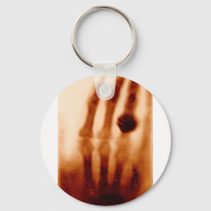 Porte-clés Le premier X-Ray, 1901, photo