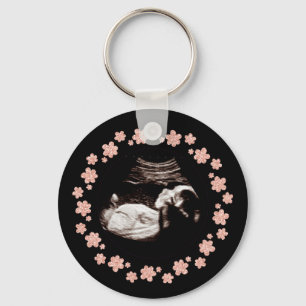 Porte-clés Pregnancy Baby Glitter Sonogram Ultrasound Photo