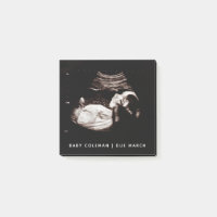Pregnancy Baby Sonogramme Ultrasound Photo