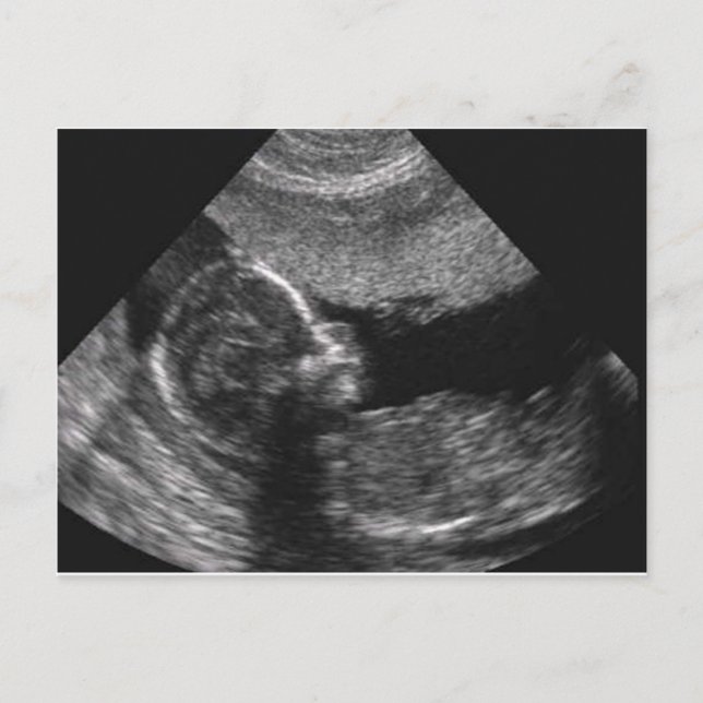 Postale visage de bébé, carte (Devant)