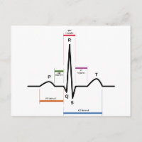 Postcard Sinus Rhythmus Elektrokardiogramm EKG