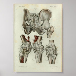 Poster 1844 genoux vintages de hanche d'impression