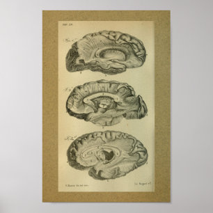 Poster 1850 Vintage anatomie Imprimer Lobes Cerveau