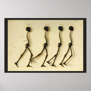 Poster Analyse de la démarche à pied Chiropratique de la 