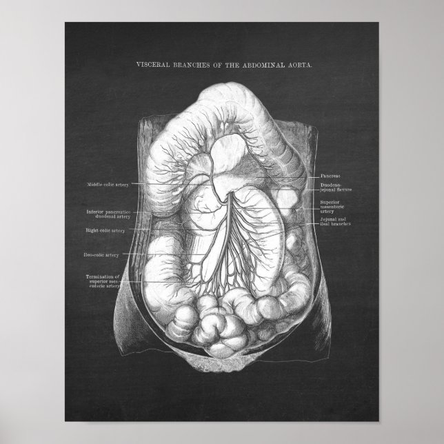 Poster Anatomie de l'aorte abdominale (Devant)