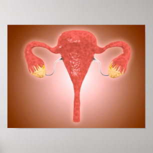 Poster Anatomie de l'utérus femelle avec des ovaires