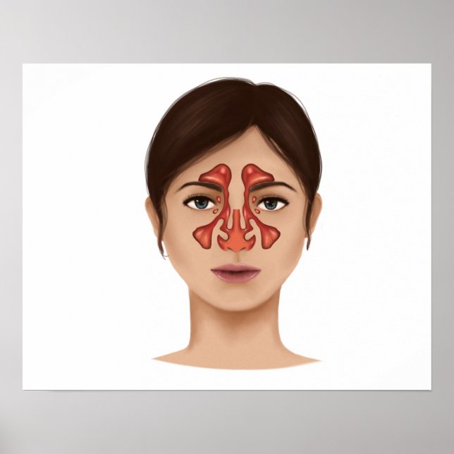 Poster Anatomie Des Sinus Nasaux (Devant)