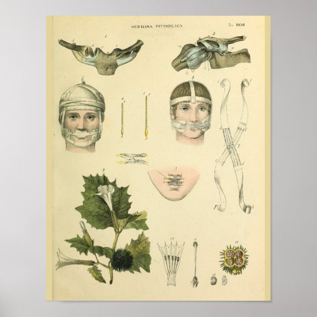 Poster Anatomie Vintage de l'épaule (Devant)