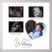 Baby Scan Photo sonogramme nouveau-né gardien de b