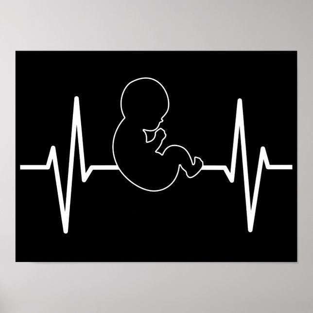 Poster Bébé Pro-Vie poulse pulse EKG : foi chrétienne (Devant)
