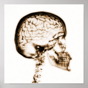 POSTER CERVEAU JUMEAU X-RAY - ORANGE